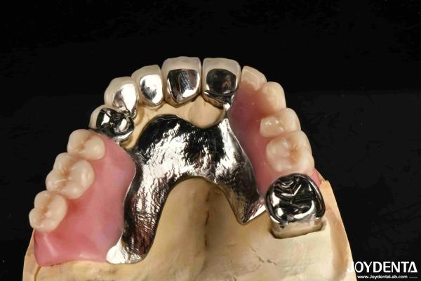 Quality Elaborate Framework Final Set Stable Dental Structure Designed Teeth Finish for sale