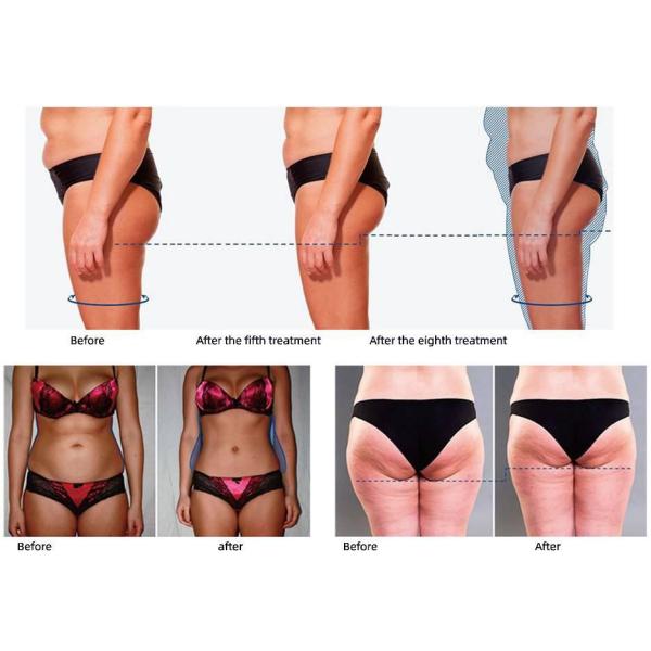 Portable Emslim RF Body Slimming Machine Hiemt EMS Weight Loss 4 Handles