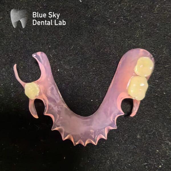 Quality Customize Removable Acrylic Partial Denture Natural Looking Valplast Dental Partials for sale