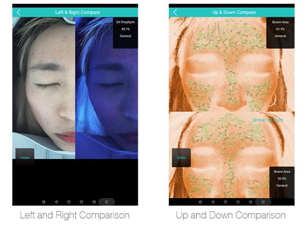 Quality 10.6kg Gw Face Skin Analysis System 20mega Pixels Fda Fc Certificate for sale
