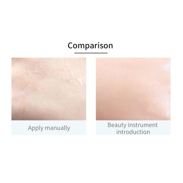 Skin Rejuvenaiton RF EMS Handheld Facial Beauty Device