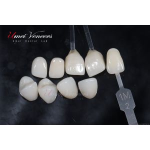 Natural Bright White Veneers