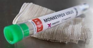 Monkeypox Virus Detection Reagent Real Time PCR Kit