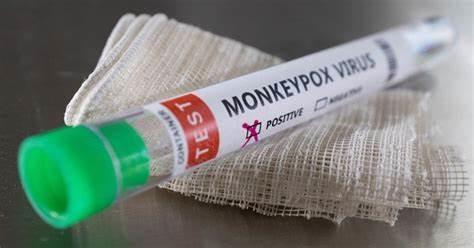 Quality Monkeypox Virus Detection Reagent Real Time PCR Kit for sale
