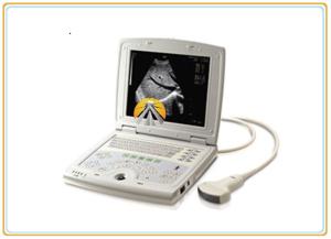 China Digital Laptop Ultrasound Scan Machine Convex Array Probe 10.4 Inch Screen on sale