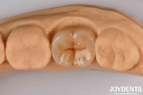 Quality High Precision Applications Full Zirconia With High Resistance To Thermal Shock for sale