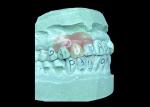 Lightweight and Comfortable Nesbit Flexible Denture for Single Tooth Replacement