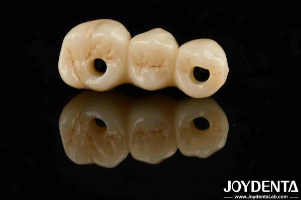 Quality High Aesthetics High Flexural Strength 1000 MPa Full Zirconia For Standards for sale