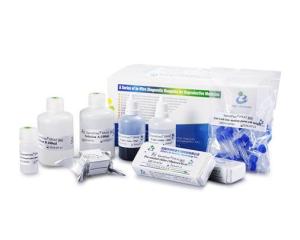 Buy cheap 40 Tests / Kit SCD Method Sperm DNA Fragmentation Test Kit Wright Staining Dye product
