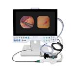 All in One Rigid and Flexible Endoscopy Camera TU-15LSD1E HDMI/SDI/CVBS/VGA/DVI