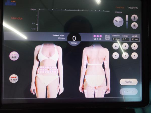 Quality HIFU ultrasounic transducer for face lifting / ultrasound face lift for sale