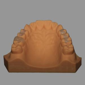 Buy cheap Full Ceramic Dental Emax Inlay Onlay Crown Pressed / Milled from wholesalers