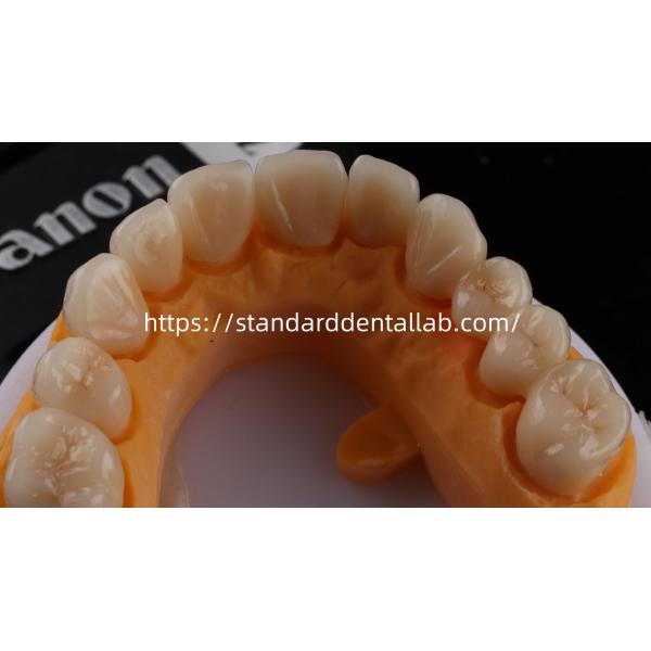 Layered Dental Zirconia Crown And Bridge Translucency 3D PRO Zirconia Porcelain Crown Standard Dental Lab