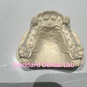 Removable Cast Clear Framework Partial Easy To Clean And Take Off
