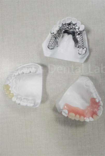 Quality Long Lasting Flexible Removable Partial Denture Easy Cleaning Replace Missing Teeth for sale