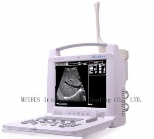 Labtop Ultrasound Scanner Machine with 2 connectors
