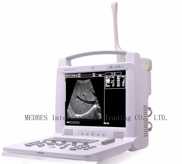 Quality Labtop Ultrasound Scanner Machine with 2 connectors for sale