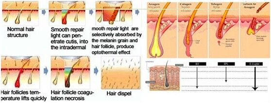 factory sale 3000 W big power IPL OPT SHR Hair Removal Machine for salon use