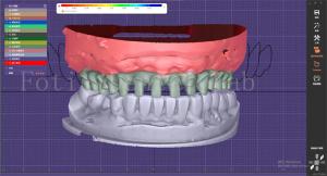 OEM Mouth Models Maker Dental Design Service With Tooth Blueprint Builder