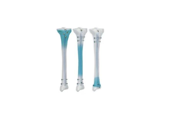 Quality Implanted Tibial Intramedullary Interlocking Nail FDA for sale