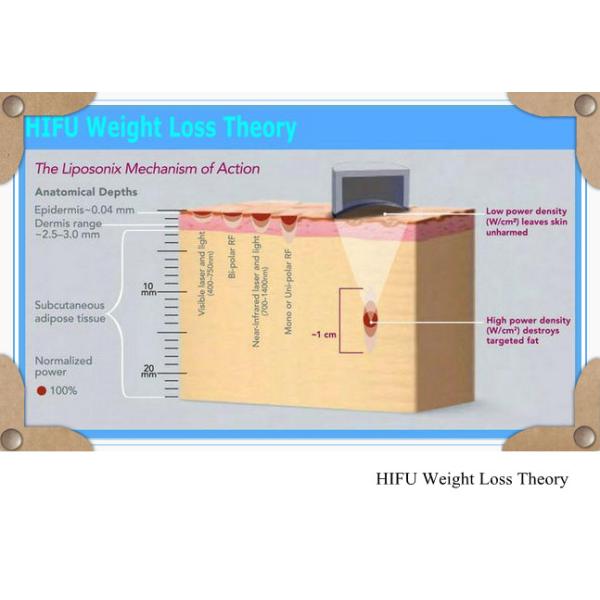 Fast cellulite reduction machine HIFU body slimming system