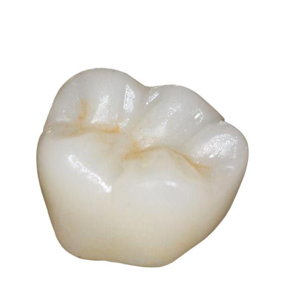 ISO Zirconia Dental Crown Computer Numerical Control Processing Good Biocompatib