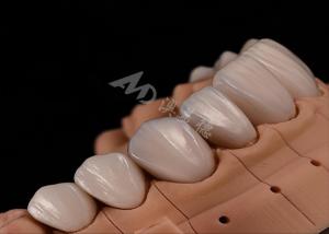 Strength Natural Esthetics Teeth Zirconia Crowns For Precise Fit Chip Resistance