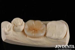 800 MPa Flexural Strength And 8 MPa·m1/2 Fracture Toughness In Multilayer Full Zirconia For Strength Applications