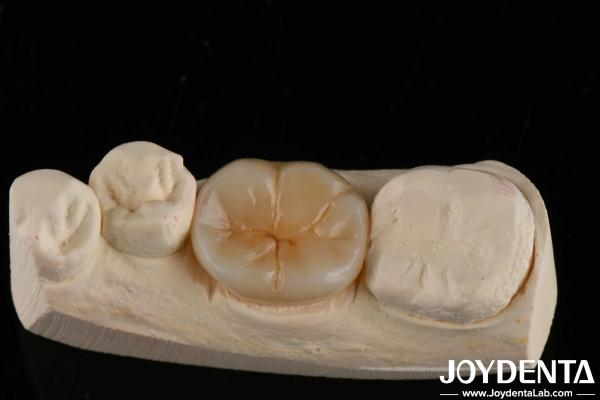 800 MPa Flexural Strength And 8 MPa·m1/2 Fracture Toughness In Multilayer Full