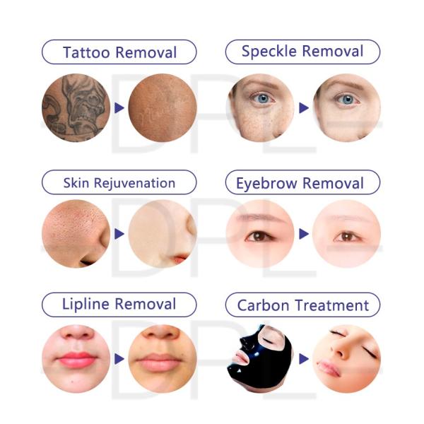 DPL Professional picosecond pigmentation skin care 1064 755 laser nd yag q-switched system nd yag laser 2022