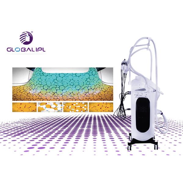 5 In 1 Ultrasound Therapy Cryolipolysis Machine Automatic Temperature Control System
