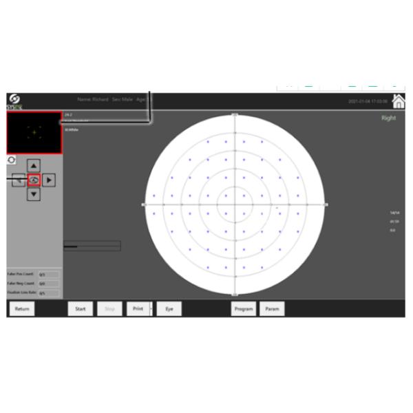 Inspection Categories 200ms Visual Field Analyzers International Goldman Standard