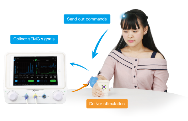 High Efficiency Emg Triggered Electrical Stimulation Device With Restore Nerve Function
