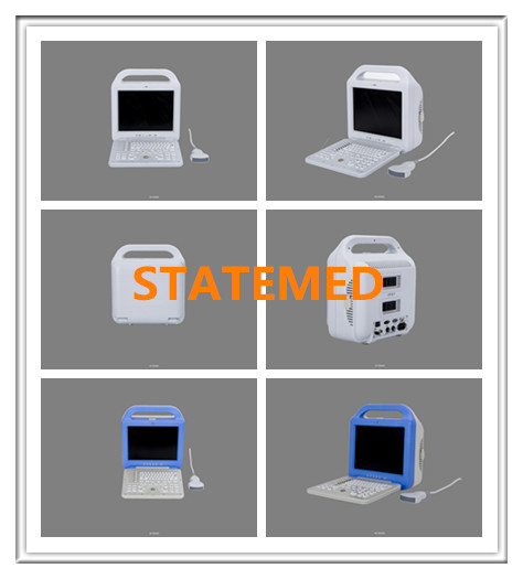 Hospital Laptop Ultrasound Scanner , 240 MM Scanning Depth Portable Ultrasound Equipment