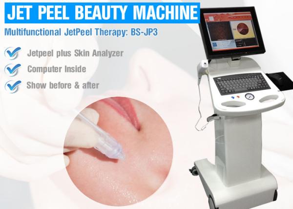 Quality OEM Water Oxygen Jet Peel Oxygen , Skin Rejuvenation Machine For Facial Peeling for sale