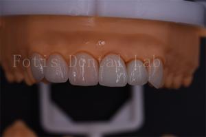 1 Day Digital Crowns Excellent Compatibility With Easy Transmission Via Email Or Software