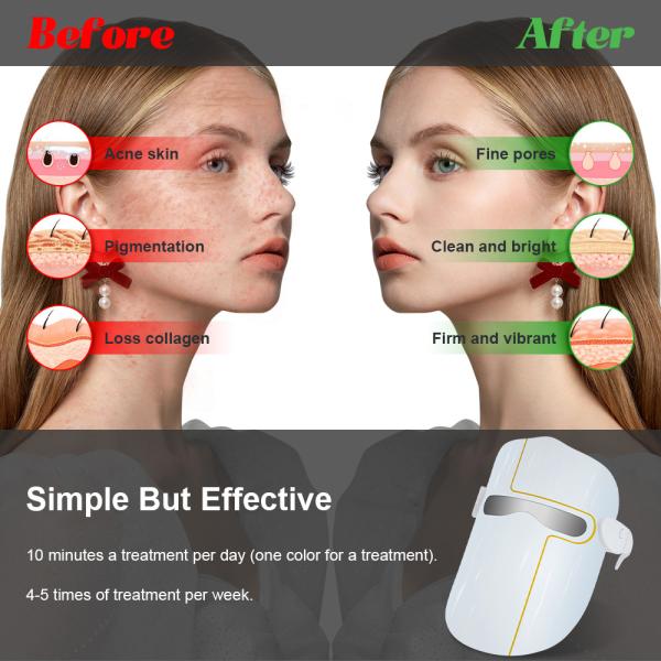 Red Blue Yellow LED Light Therapy Mask 3.7V Skincare Light Mask