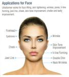 Vertical Stationary HIFU Beauty Machine For Face Lifting / Wrinkle Removal