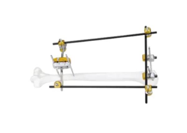 Quality Proximal Humerus Medical External Fixator for sale