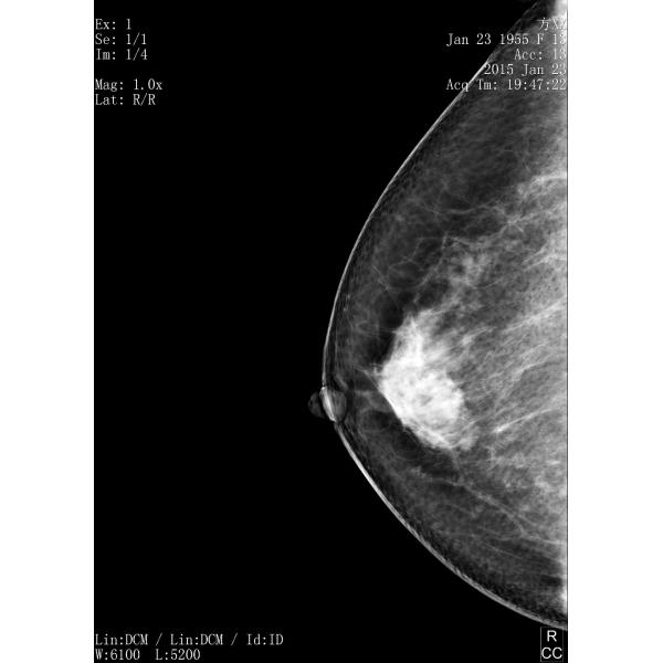 Full Digital Mammography System with Panel Detector for Sales