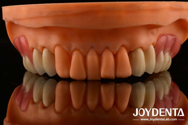 Quality Framework Setup Teeth Finish Elaborate Technology Beautiful Harmonious Appearance Design for sale