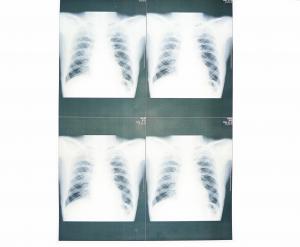 China White Base Medical X Ray Paper Film Moistureproof For Sony / EPSON Laser Printer on sale