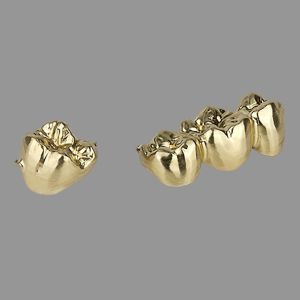 Buy cheap Dental Clinics Full Gold Crown Smooth Polished Wear Resistant from wholesalers