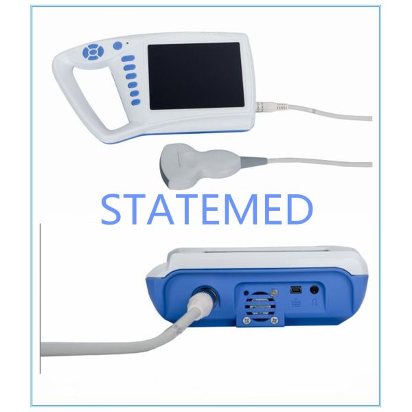 Human Full Digital Palm Black / White Ultrasound Scanner 3stage Frame Function