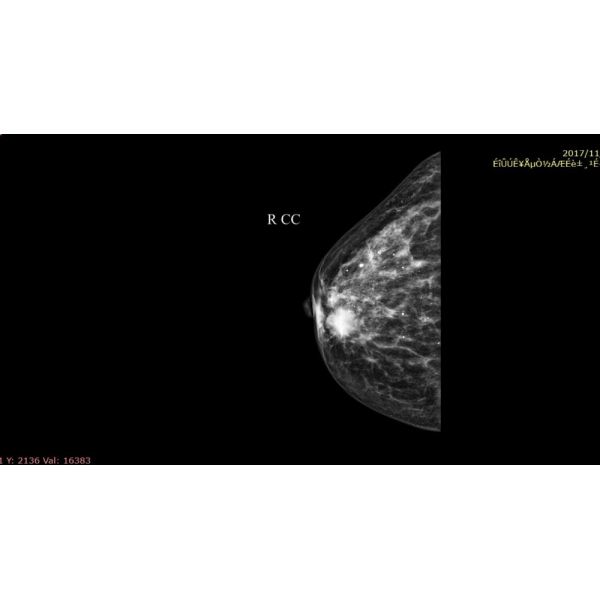 Full Digital Mammography System with Panel Detector for Sales