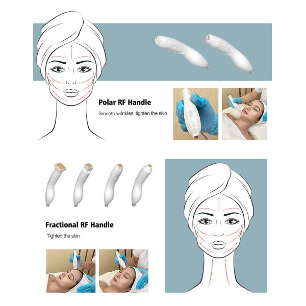 Electric Microcurrent Multipolar RF Therapy Anti Aging Face Wrinkle Removal Machine
