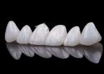 Natural Looking Zirconia Tooth Crown Stain Resistance All Zirconia Crown