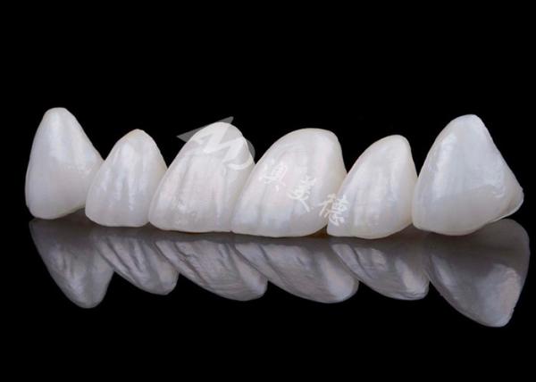 Natural Looking Zirconia Tooth Crown Stain Resistance All Zirconia Crown