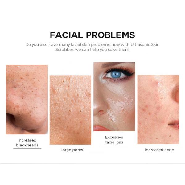 Ultrasonic Ion Therapy Vibrating Facial Scrubber Skin Clean Peeling Warm Scraper