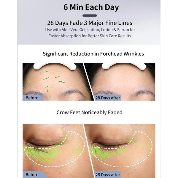 RF EMS Electric Vibrating Facial Massager Personal Care Skin Lifting